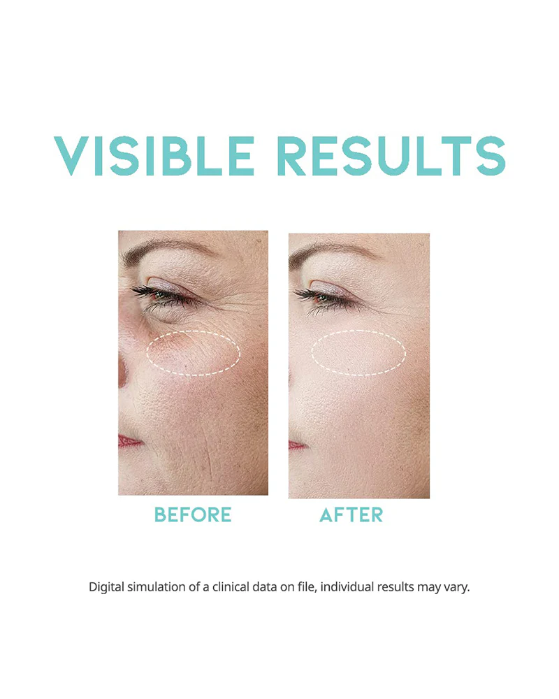 #OOTD Wrinkle Lift Retinol Serum - Image 4