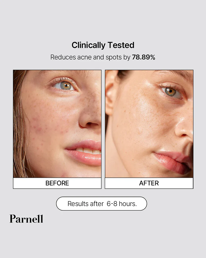 Parnell Cicamanu Clear Patch (68 patches) - Image 5